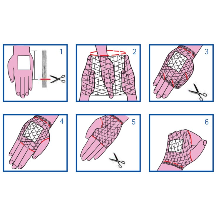 FILET TUBULAIRE ÉLASTIQUE CALIB 2